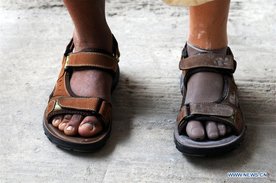 YEMEN-SANAA-DISABLED MEN